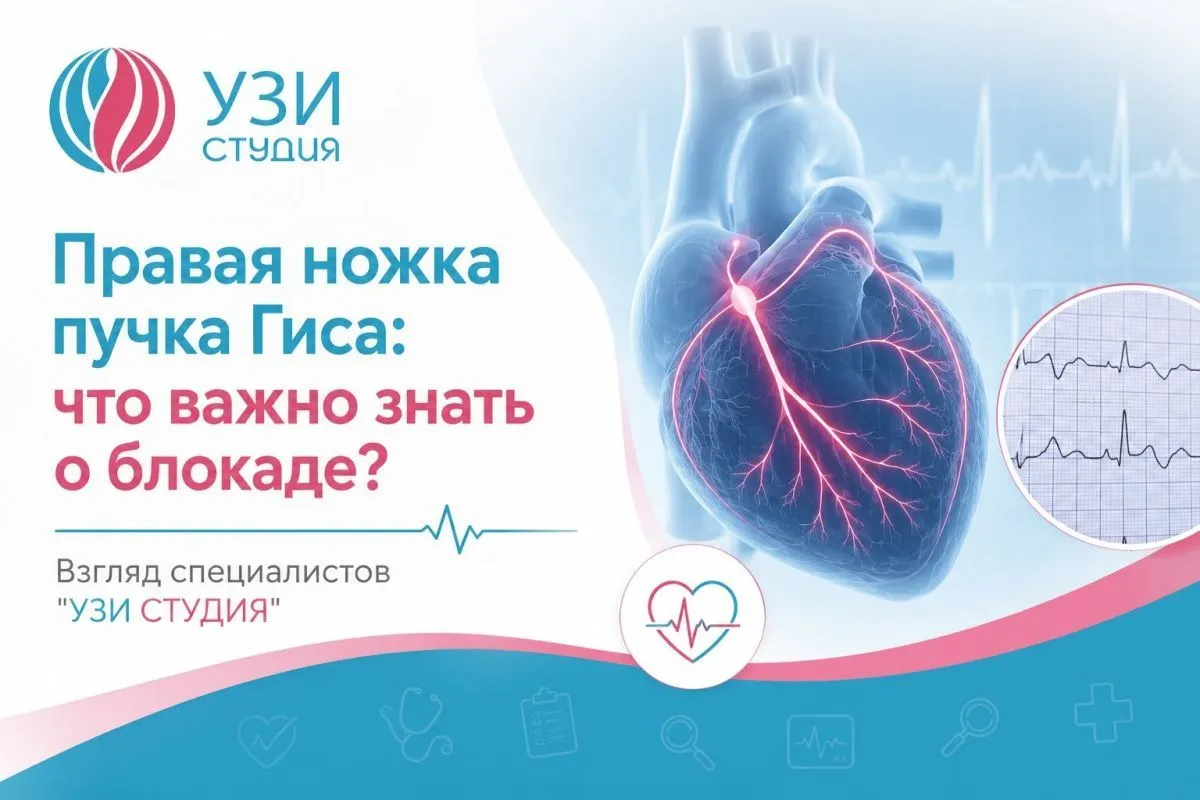 Правая ножка пучка Гиса: что важно знать о блокаде. Взгляд специалистов «УЗИ Студия»