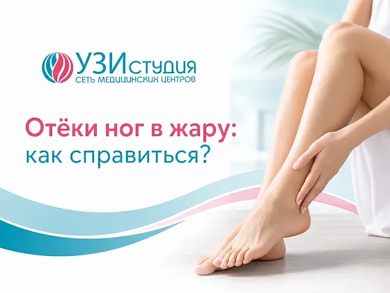Отёки ног в жару: причины, симптомы и рекомендации врачей