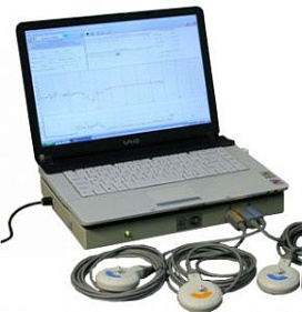 Кардиотокограф - интранатальный фетальный монитор с автоматическим анализом КТГ «Уникос» 
